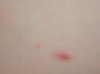 bouton a.jpg