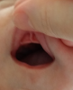levre sup.png