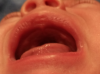 frein-levre.png