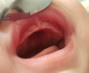 frein-levre-2.png